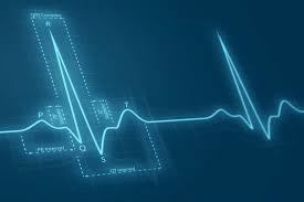 Electrocardiogram